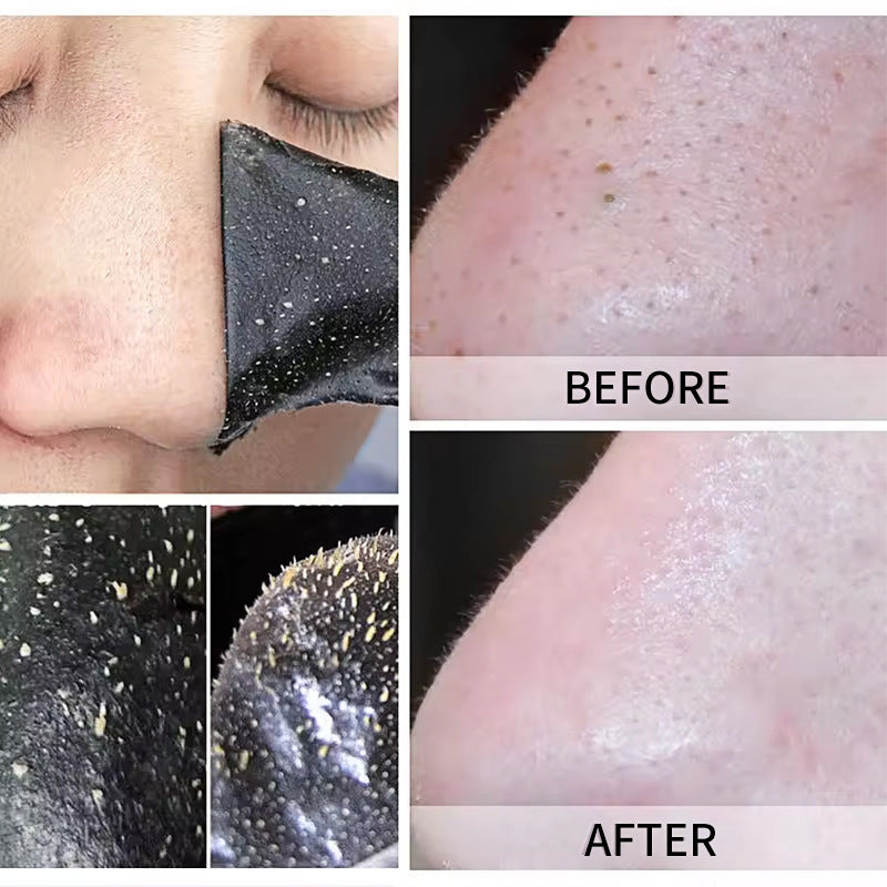 Nose Pore Cleansing Strip