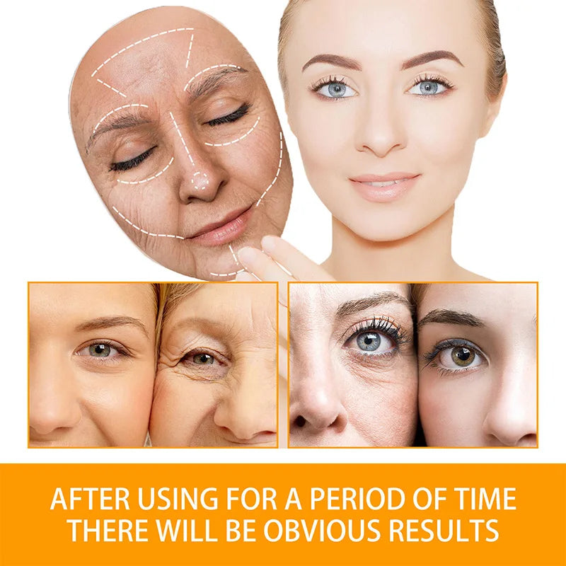 Anti-Acne Turmeric Cream 50ml