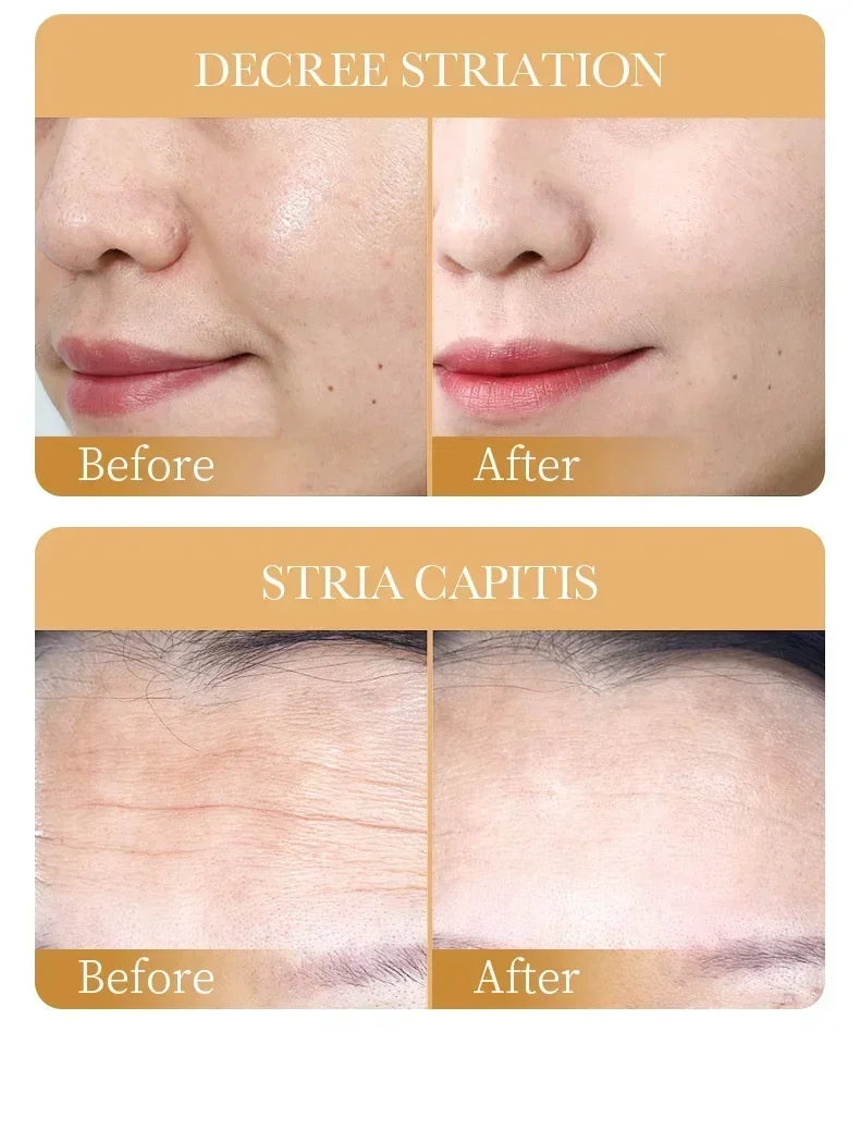 SADOER Collagen Anti-Wrinkle Face Mask