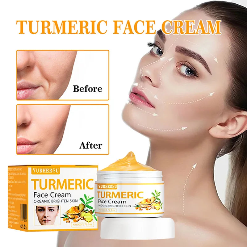 Anti-Acne Turmeric Cream 50ml