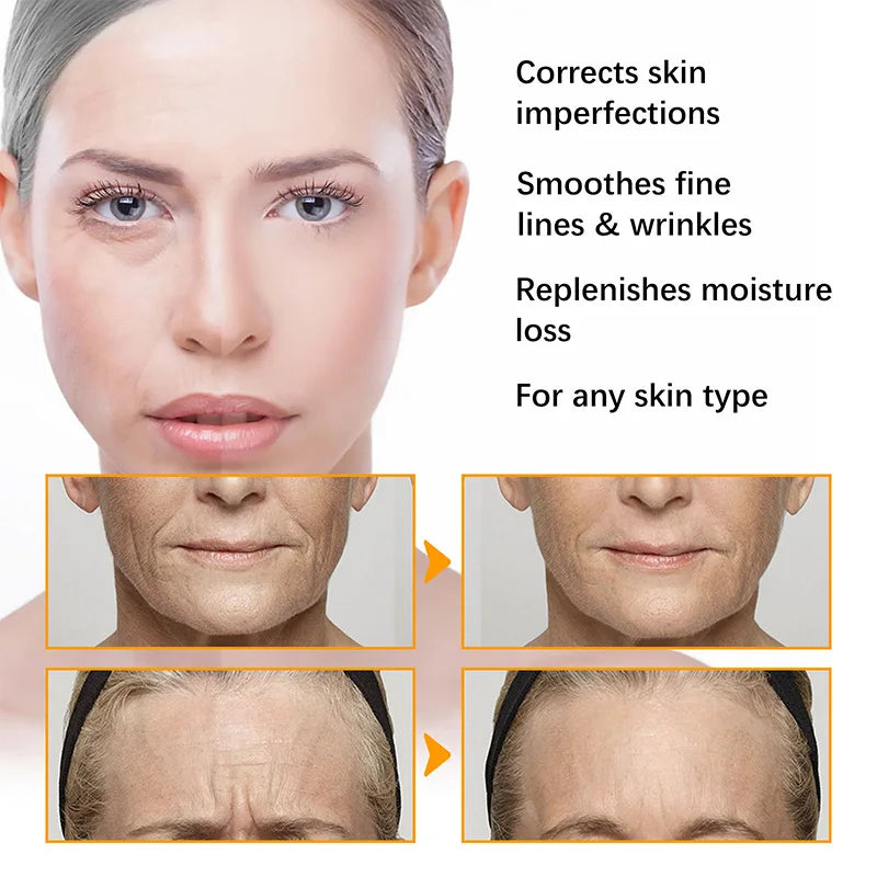 Anti-Acne Turmeric Cream 50ml